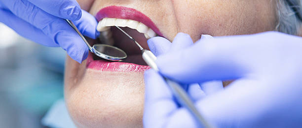 Best Emergency Treatment for Toothache in Evansville, IN